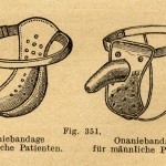 Ceinture anti-masturbation